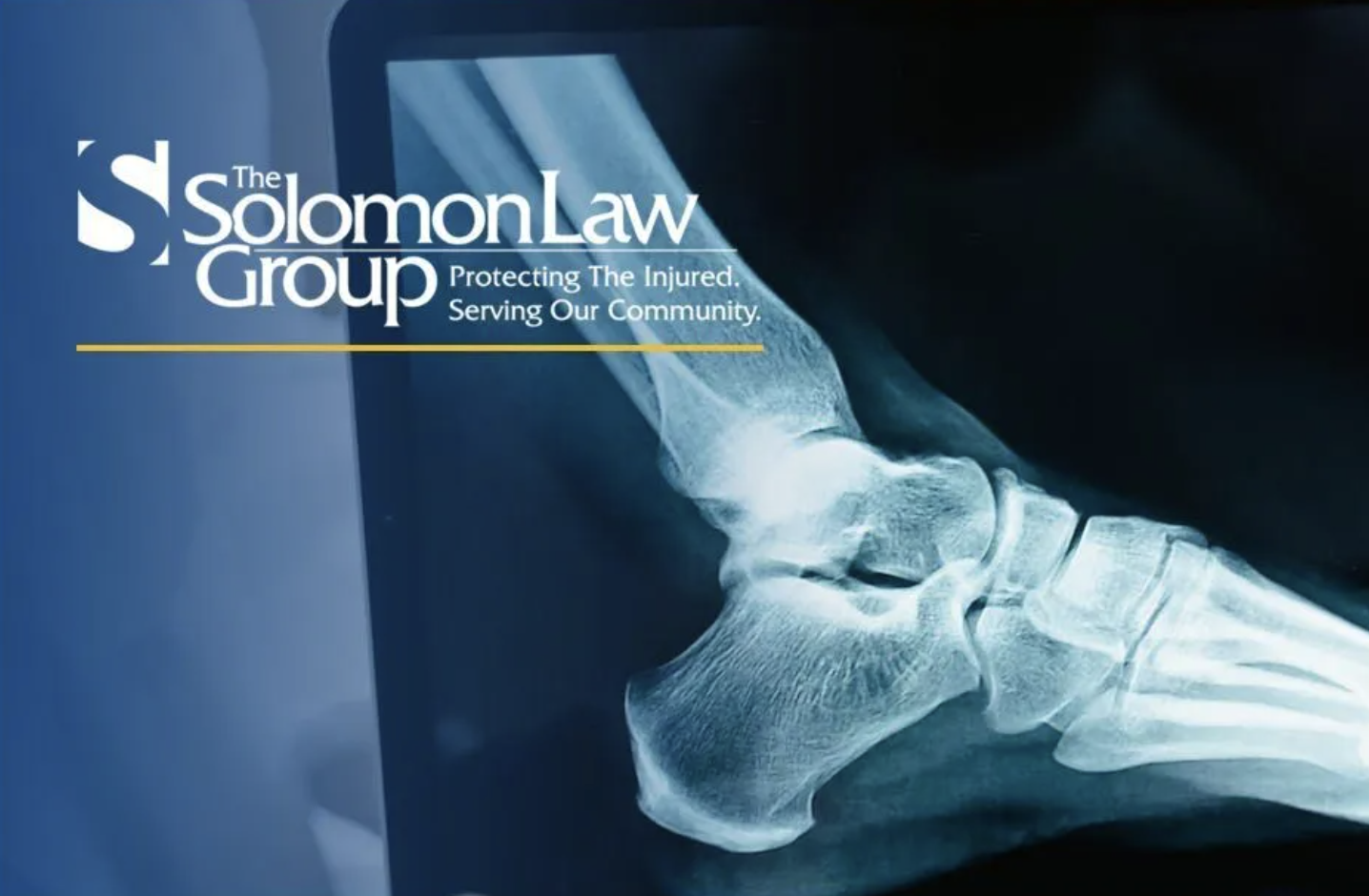 Personal Injury Claims and Joint Liability
